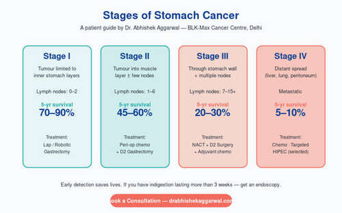 Stomach Cancer — clinical infographic by Dr. Abhishek Aggarwal